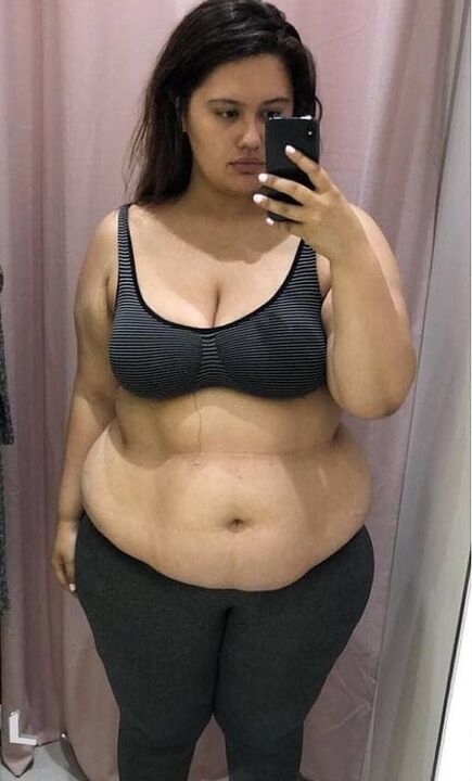 ზედმეტი კილოგრამების გამო მძულდა ჩემი სხეული.